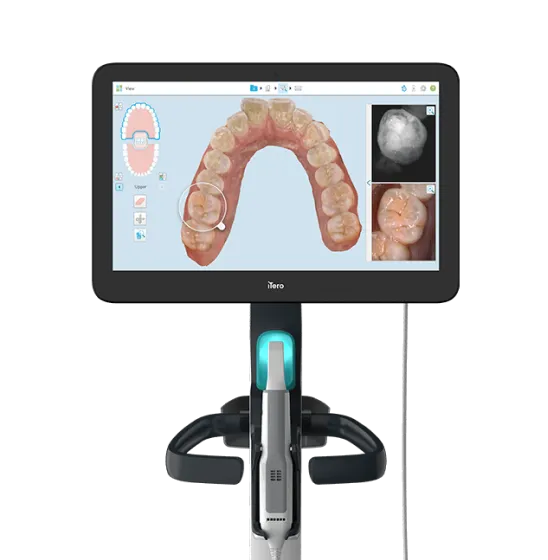 最新型3D光学スキャナー(iTero)も導入